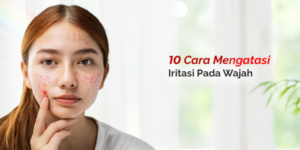 10 Cara Mengatasi Iritasi pada Wajah