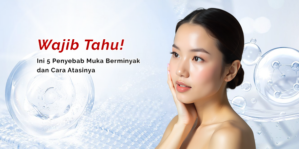 Wajib Tahu! Ini 5 Penyebab Muka Berminyak dan Cara Atasinya